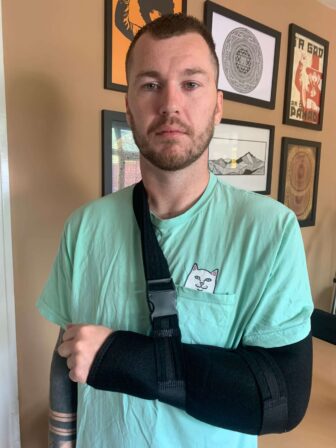 Sam Humphreys with his broken arm in a sling